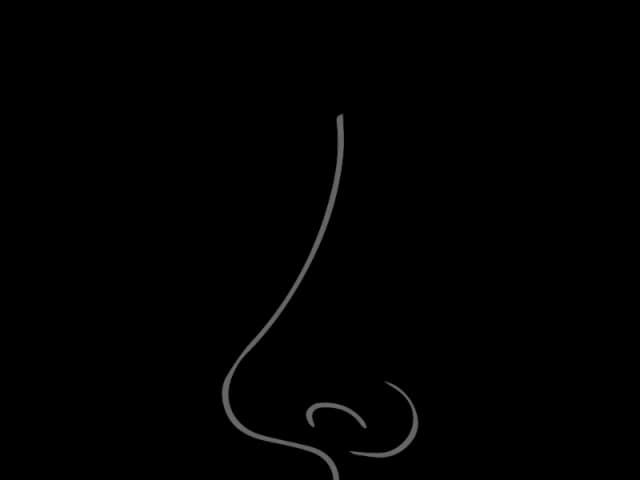 Rinoplasti